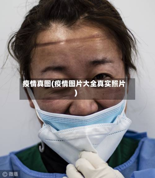 疫情真图(疫情图片大全真实照片)-第2张图片