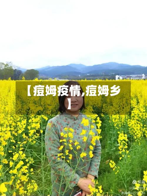 【痘姆疫情,痘姆乡】-第2张图片