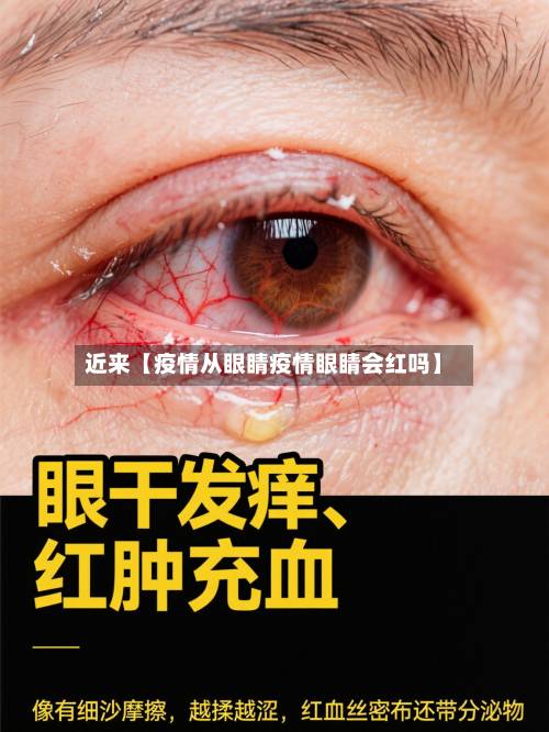 近来【疫情从眼睛疫情眼睛会红吗】-第2张图片